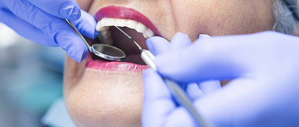 Best Emergency Wisdom Teeth Removal in Fincastle, TN